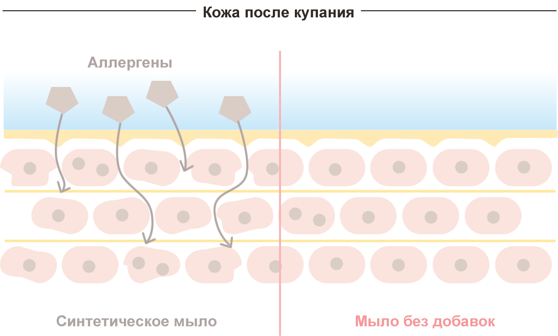 Схема поверхности кожи после купания, на которой изображены аллергены, проникающие в кожу после использования синтетического мыла. Однако при использовании мыла без добавок, аллергены отсутствуют.